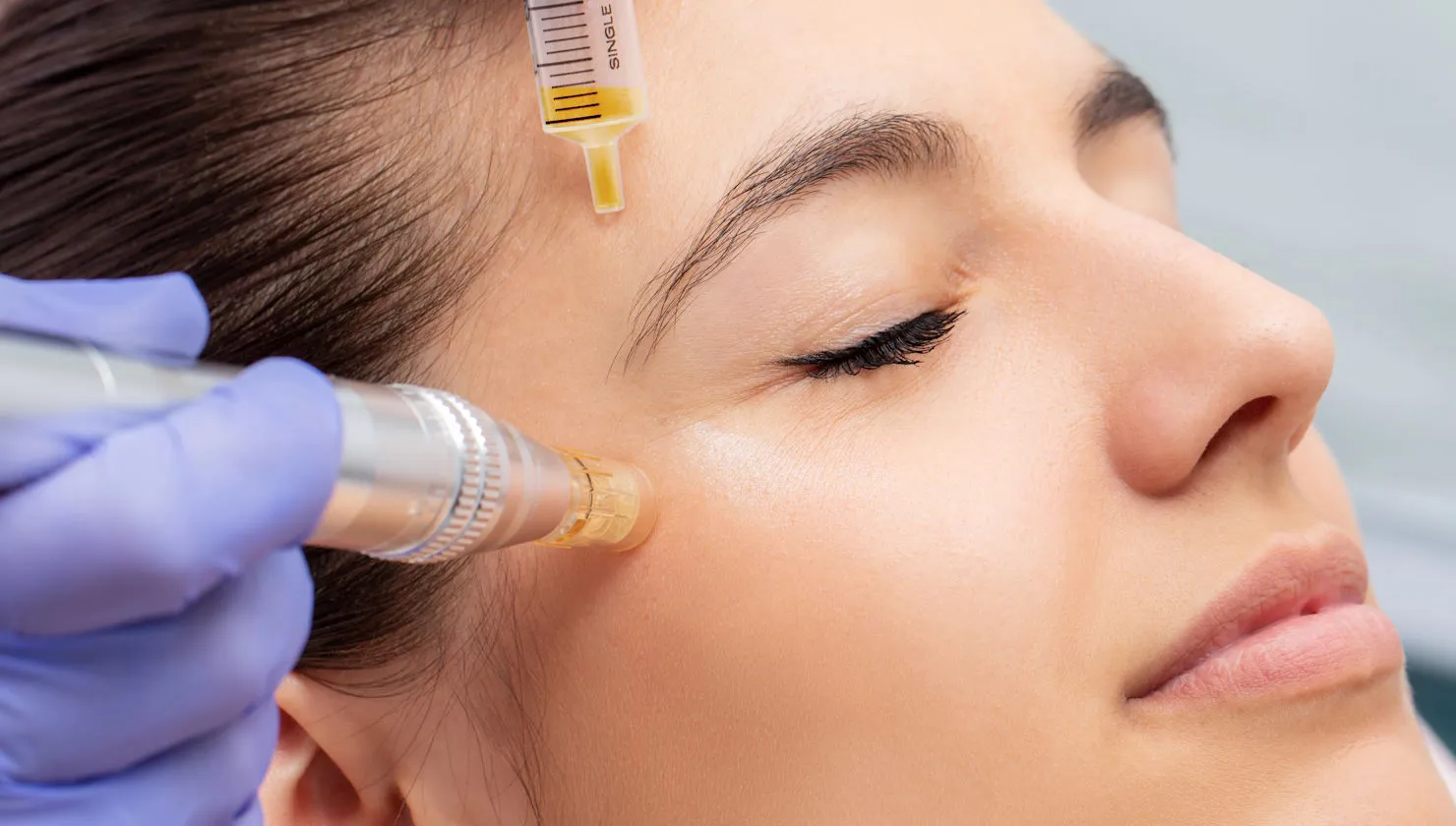 Nano Needling Facial Near Me in Frisco, TX | Nanoneedling Facial Near Me in Frisco, TX